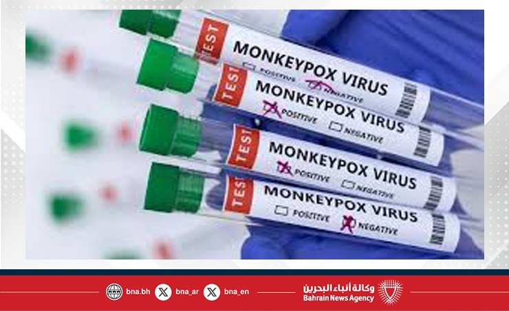 ألمانيا: تسجيل أول حالة اصابة لمتحور جدري القردة